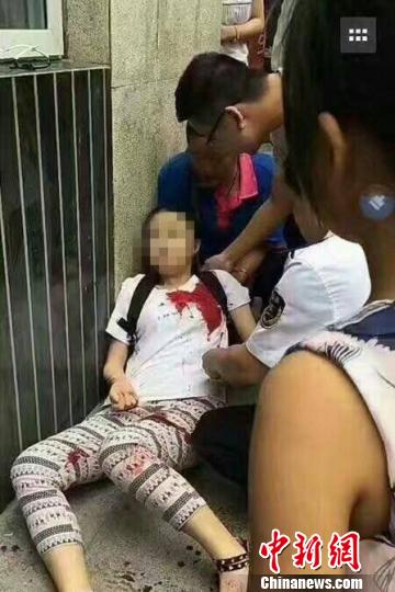 四川达州街头发生三起伤人事件 四川达州街头发生三起伤人事件均为一人所为