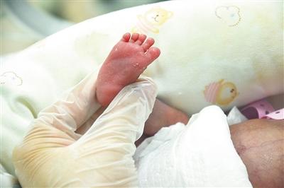 超级小宝宝提前4个月出生 身长27厘米仅有490克