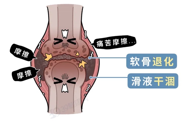 且行且珍“膝” 保护膝盖建议做好这几件事