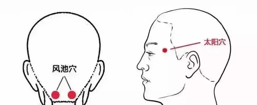 这种头疼会致残!千万别以为是小毛病