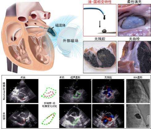 国家心血管病中心联合中国科学院发布磁流体心脏内3D打印技术