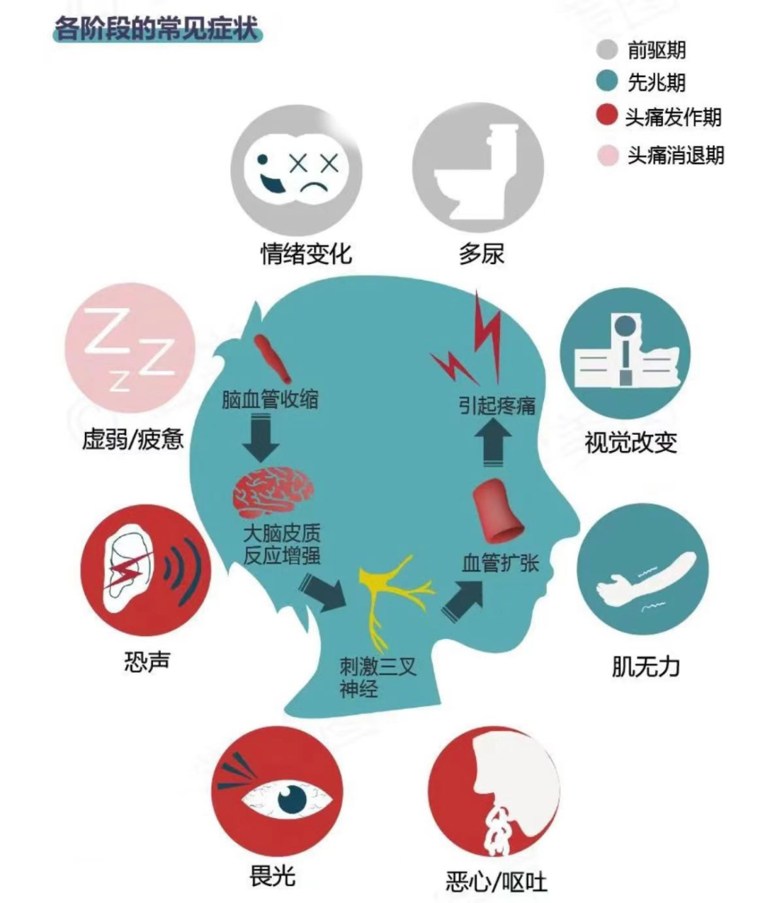 这种头疼会致残!千万别以为是小毛病